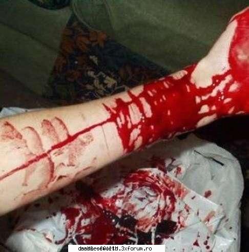 blood pics - you guys asked for it - †Blood†